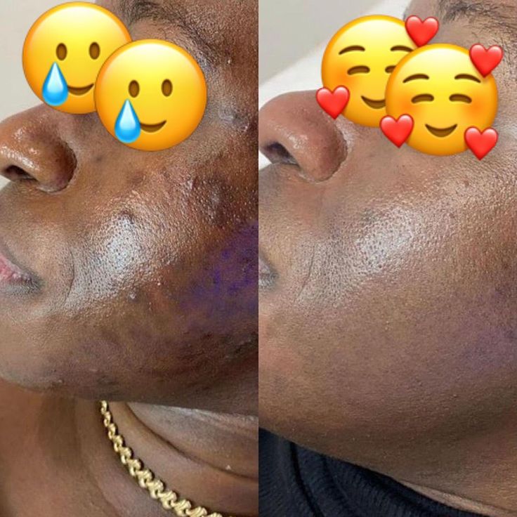 THE ORDINARY – NIACINAMIDE 10% + ZINC 1% - Kora Market